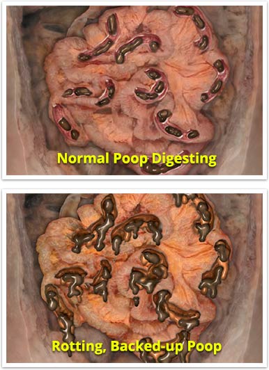 poop-pics